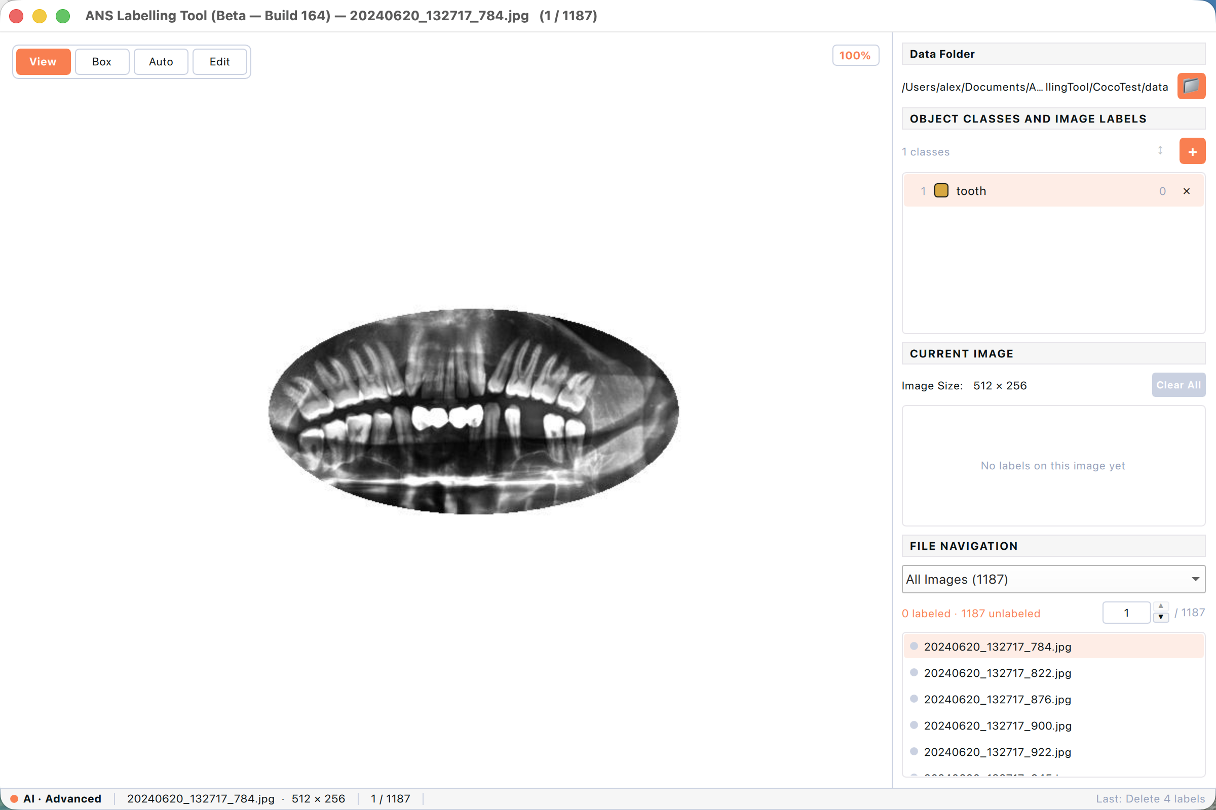 A freshly opened CocoTest folder. 1,187 unlabeled images, no categories defined yet.